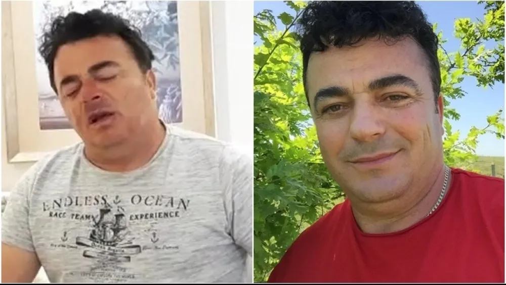 Албански бизнисмен тврди да је сексуално злостављан: Опљачкали му стан и одсјекли прст