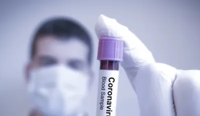 korona virus test