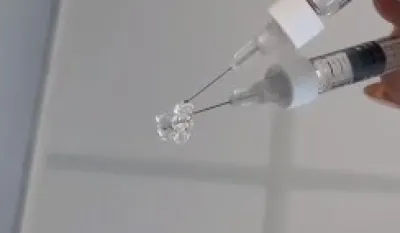 (VIDEO) Da li znate kako izgleda hijaluron koji se stavlja u usne?