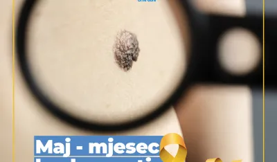 Maj &ndash; mjesec borbe protiv melanoma