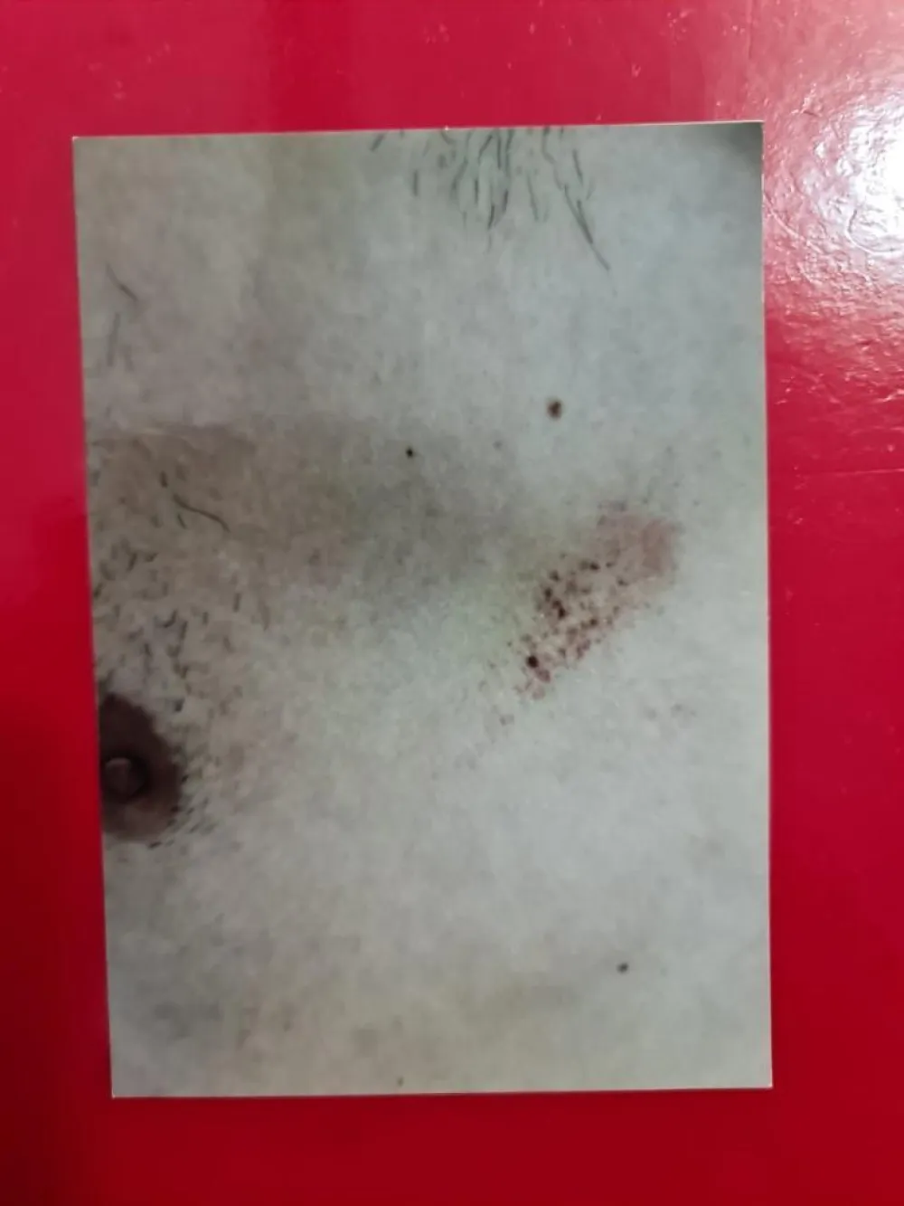 Суду достављено 12 фотографија повреда