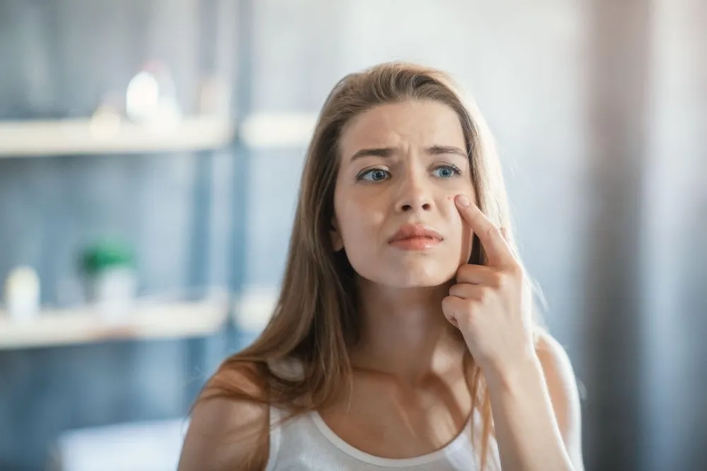 Problem skin treatment. Upset young lady with pimple on her cheek near mirror indoors,Image: 555666294, License: Royalty-free, Restrictions:, Model Release: yes, Credit line: Prostock-studio/Alamy/Alamy/Profimedia