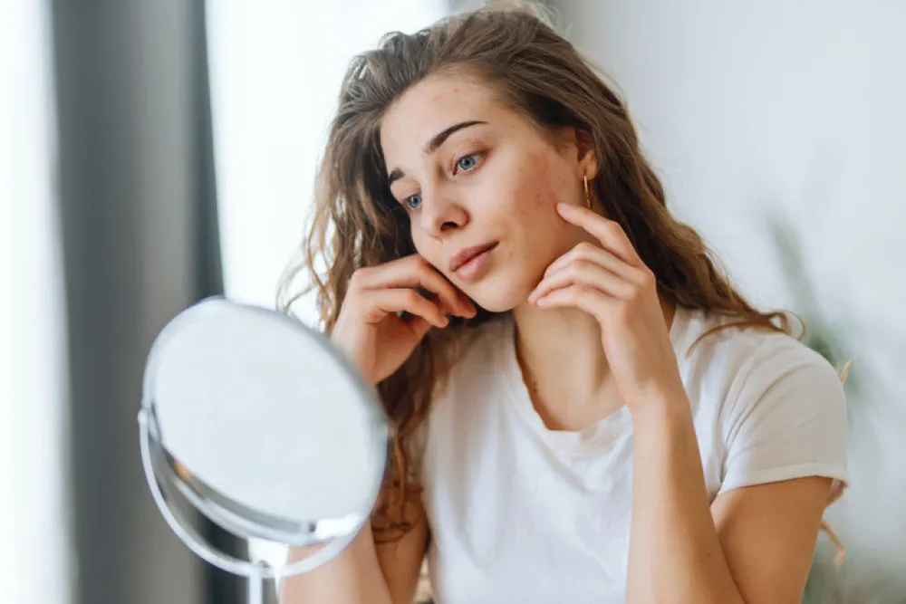 Young woman with problem skin looking into mirror.