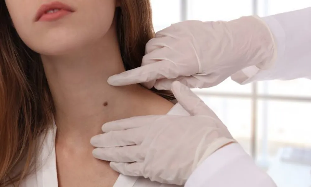 Međunarodni mjesec borbe protiv melanoma