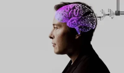 Kvar na Neuralink čipu u mozgu: Maskova firma htjela da ga ukloni