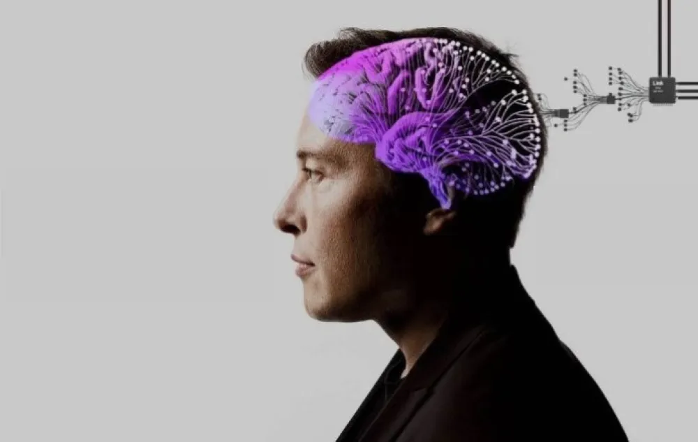 Kvar na Neuralink čipu u mozgu: Maskova firma htjela da ga ukloni