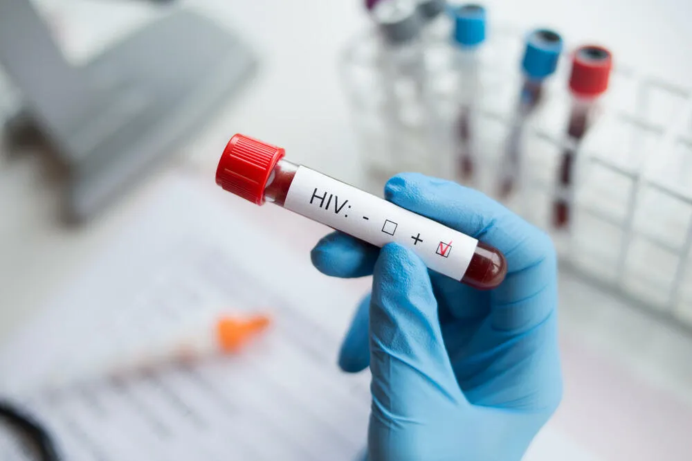 HIV otkriven kod jednog dobrovoljnog davaoca krvi