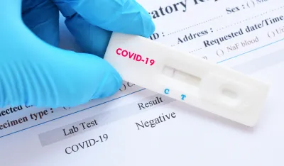 Koronavirus ipak nastao u laboratoriji?