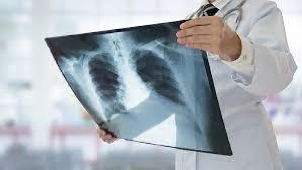Borbu sa kancerom godi&scaron;nje izgubi 2.000 osoba