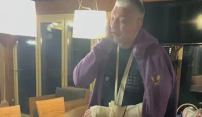 Čeda Jovanović u gipsu