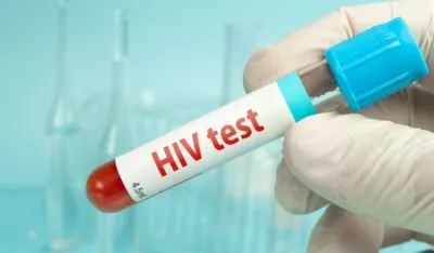 Sjutra besplatno testiranje na HIV