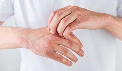 Kako prepoznati da va&scaron;em organizmu nedostaje vitamin C