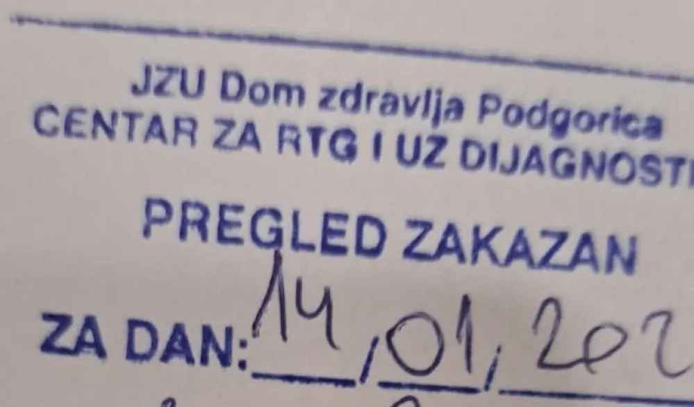 Jedan RTG aparat na 200.000 stanovnika