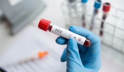 Vakcina za za&scaron;titu od HIV-a