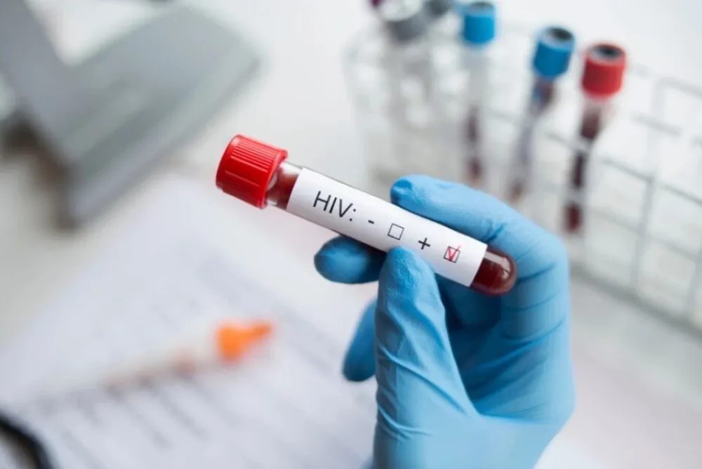 Vakcina za za&scaron;titu od HIV-a