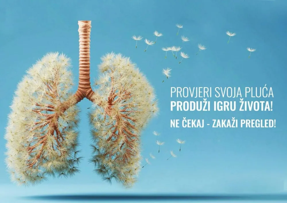 Produži igru života