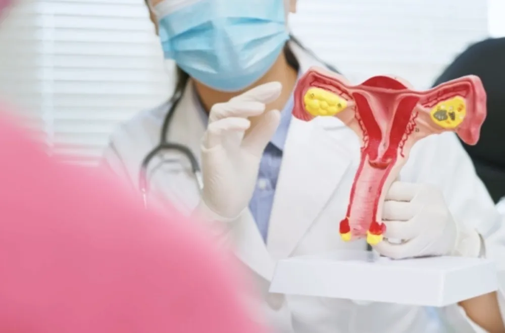 Naučnici razvili medicinski tampon koji može da otkrije rane znakove raka jajnika