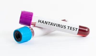 Preminule tri osobe na kruzeru, sumnja se na hanta virus
