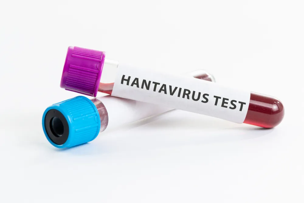 Preminule tri osobe na kruzeru, sumnja se na hanta virus